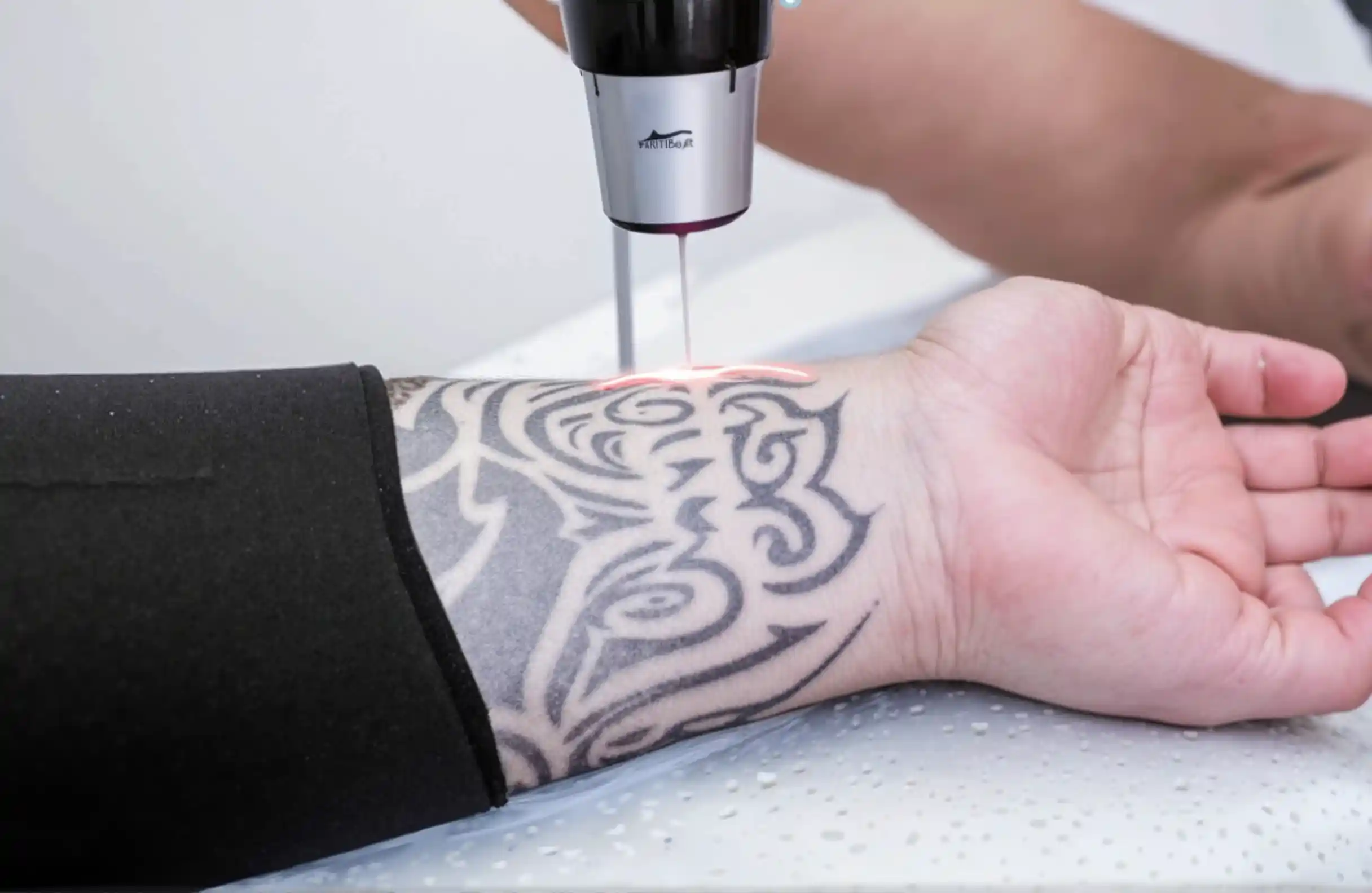 Proper aftercare being applied to a treated tattoo area